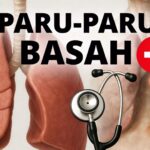Penyebab Paru-paru Basah dan Cara Pencegahannya yang Efektif
