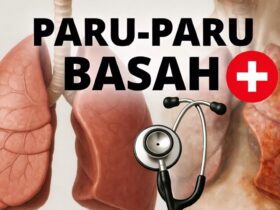 Penyebab Paru-paru Basah dan Cara Pencegahannya yang Efektif